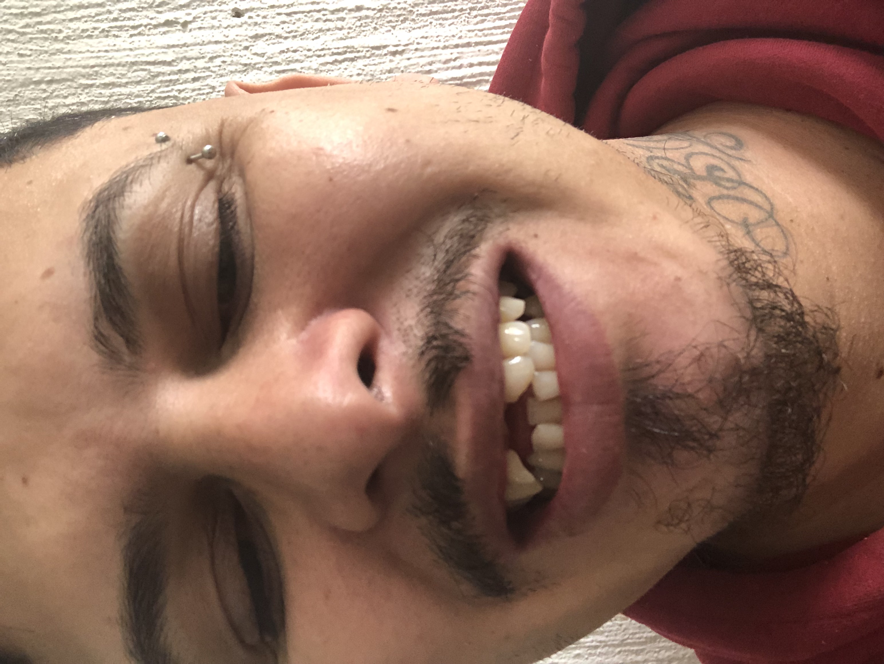 Tratamento dentário
