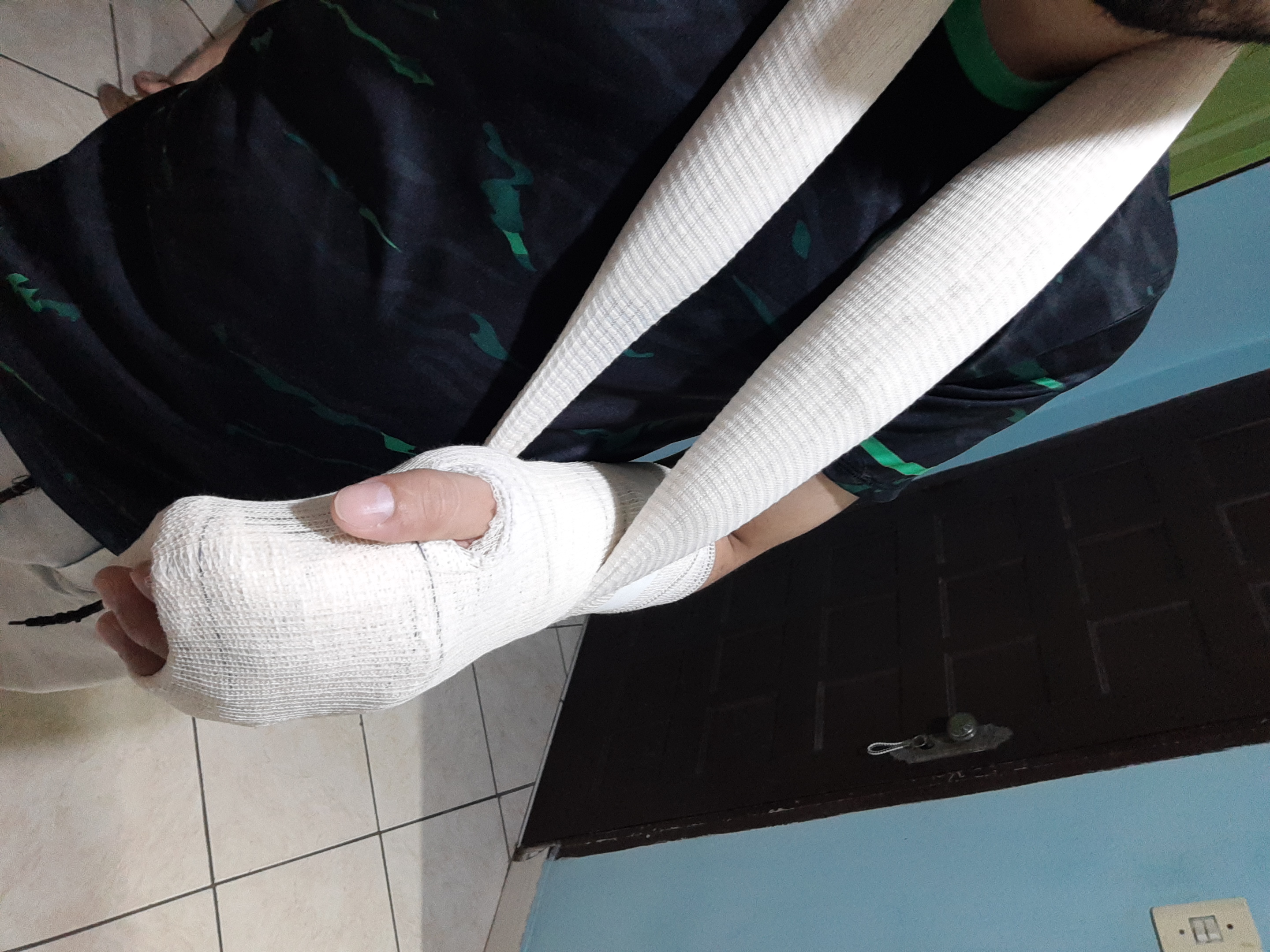 Braço Quebrado, Contas Acumuladas e Nenhum Benefício: O Drama de um Trabalhador Esquecido