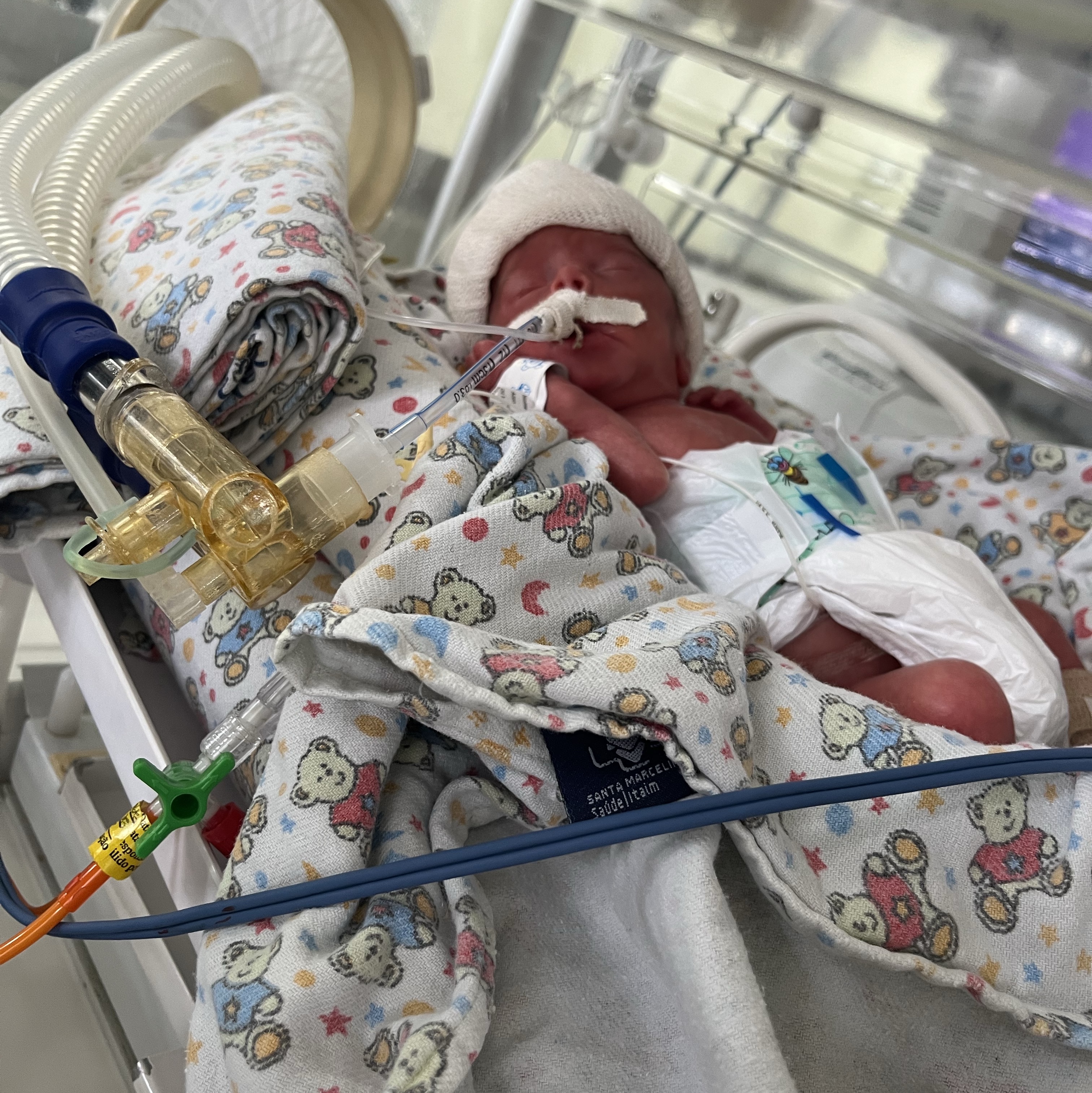 Ajuda com os custo do Uber pra visitar minha bebê que nasceu prematura e se encontra na uti